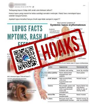 [HOAKS] Vaksin Sebabkan Lupus pada Anak Belasan Tahun