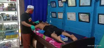 Ini Dia, Manfaat Bekam Bagi Kesehatan