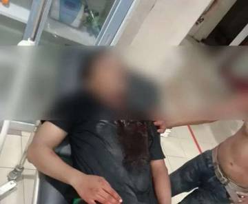 Bentrok Malam Pesta, Pemuda Wara Dibacok OTK