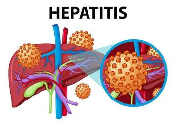 Waspadai Hepatitis, Kenali cara pencegahan dan Pengobatannya