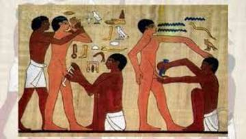 Evolusi Metode Sunat: Dari Tradisional Hingga Modern