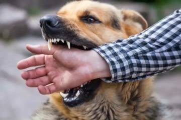 Berikut Penanganan  Pertama Saat Digigit Hewan Terduga Rabies