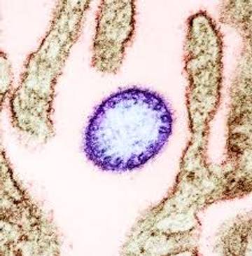 WHO Tetapkan Virus Nipah Penyakit Prioritas Riset Darurat
