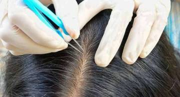 Penyebab Rambut Seseorang Cepat Beruban