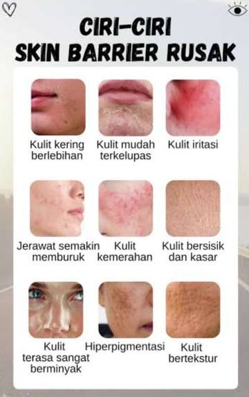 Apa Itu skin Barrier Dan Cara Memperbaikinya