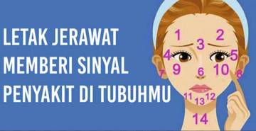 Posisi Jerawat Menentukan Kesehatanmu