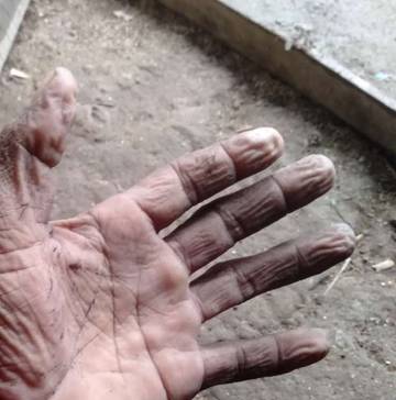 Alasaan Telapak Tangan dan Kaki Keriput Saat Berendam. 
