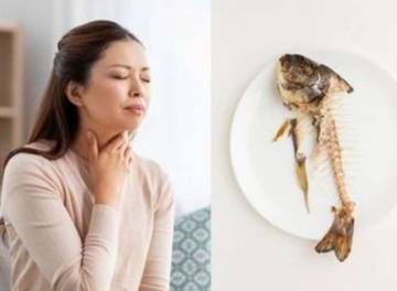 Cara Mudah Atasi Tulangan Saat Makan Ikan