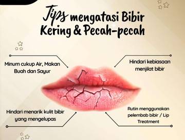 Rahasia Bibir Lembap dan Sehat Setiap Hari