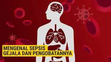 Mengenal Sepsis dan Apa Penyebabnya