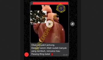 Hoaks Tidak Perlu Pasang Ring Jantung