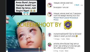 [HOAX] Video Mata Anak Bengkak Akibat Berlebihan Menggunakan HP