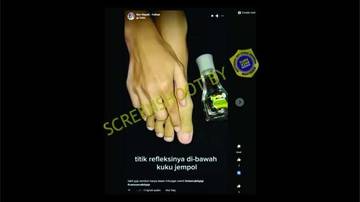 [HOAX] Memijat Kaki Bisa Sembuhkan Sakit Gigi
