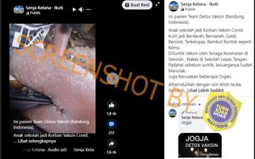 [HOAX] Sakit Kulit Akibat Vaksin Covid-19 Sembuh dengan Detoksifikasi