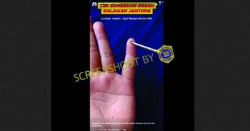 [HOAX] Jari Kelingking Bengkok Tanda Penyakit Jantung
