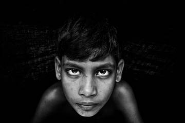 Ciri-ciri Anak Terpapar Iret