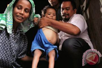 Combating Stunting In Aceh's Disaster Recovery Zones