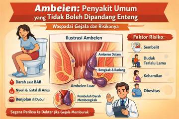 Ambeien: Penyakit Umum yang Tidak Boleh Dipandang Enteng