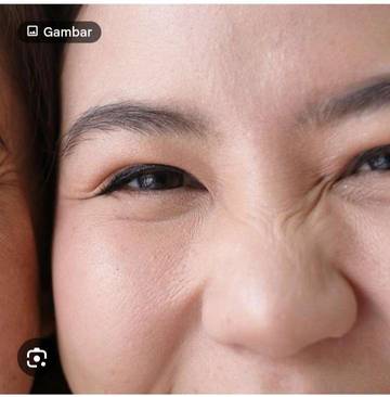 Bersyukur Punya Hidung Pesek