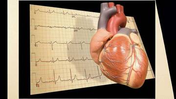 Pentingnya Pemeriksaan EKG Sebelum Olahraga Berat