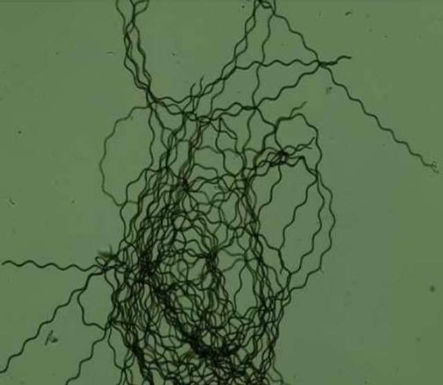 Spirulina, Mikroalga Berjuta Manfaat