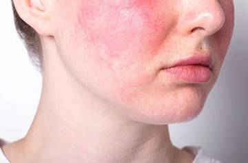 Hindari Kesalahan Ini Saat Menggunakan Retinol