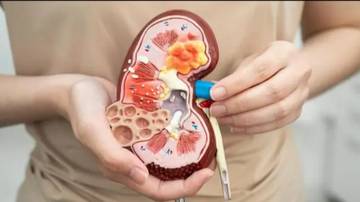 Fakta Penting tentang Tuberkulosis Ginjal