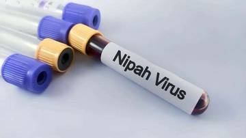 Virus Nipah Perlu Diwaspadai Masyarakat NTT