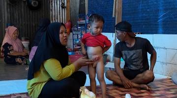 Al Fatih, Balita Pejuang Penyakit Langka Butuh Bantuan