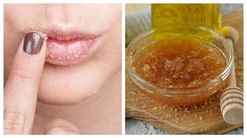 Dapatkan Bibir Cerah Alami dengan Gula dan Madu