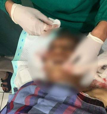 Pensiunan Polisi Gugur Ditembak OTK di Puncak Jaya