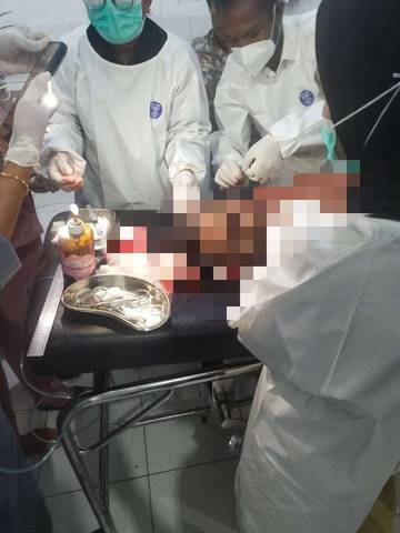 KKB Diduga Aniaya Warga Sipil di Yahukimo