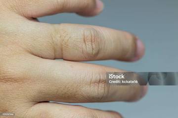 Garis Cincin Pada Tangan