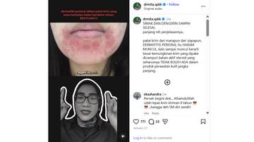 Waspada, Dermatitis Perioral Sering Dikira Jerawat Biasa