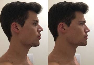 Ternyata Mewing Sebenarnya Bukan Bahasa Gaul