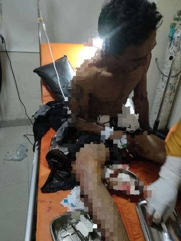 Seorang Tukang Bangunan di Palu Dianiaya OTK