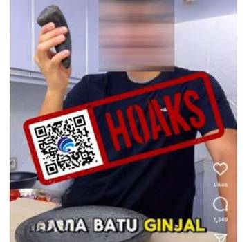 Hoaks Serpihan Ulekan Sebabkan Batu Ginjal