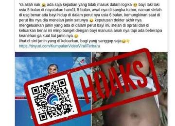 Hoaks Bayi Lima Bulan di Provinsi Sumbar Hamil
