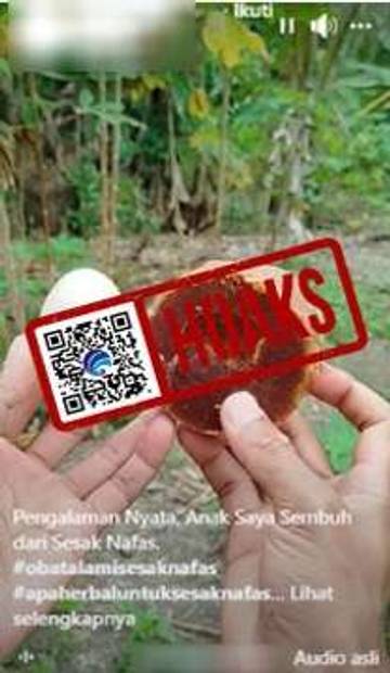 Hoaks Kuning Telur Mentah Campur Gula Aren Sembuhkan Sesak Napas Bayi