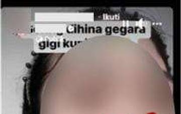 Hoaks Putihkan Gigi dengan Campuran Kopi, Kemiri, Odol