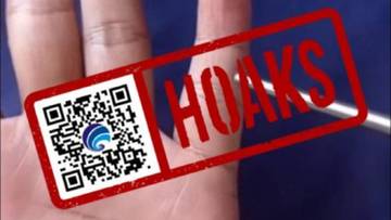 Hoaks  Jari Kelingking Bengkok Tanda Terkena Jantung