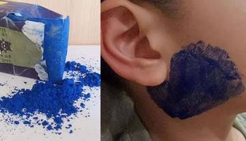 Benarkah Blau Bisa Menyembuhkan Penyakit Gondongan?