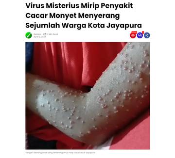 [SALAH]: Virus menyebar melalui angin di Jayapura