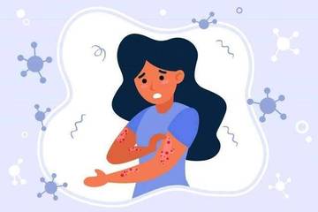 Deteksi Dini Kusta Percepat Kesembuhan dan Tekan Stigma