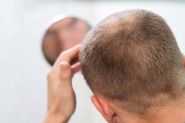 Kenali Faktor Rambut Cepat Beruban