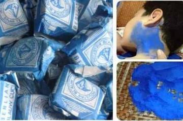 Mitos atau Fakta : Blau Dapat Menyembuhkan Gondongan