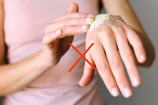 Hoaks : Pasta Gigi Sembuhkan Luka Bakar