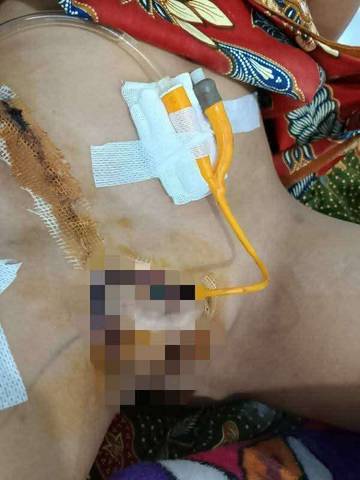 Korban Salah Sunat Di Kayu Aro Kerinci