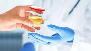 Perubahan Urine Bisa Jadi Tanda Masalah Ginjal