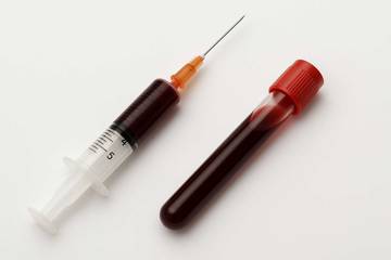Tenaga medis atasi fobia jarum saat donor darah